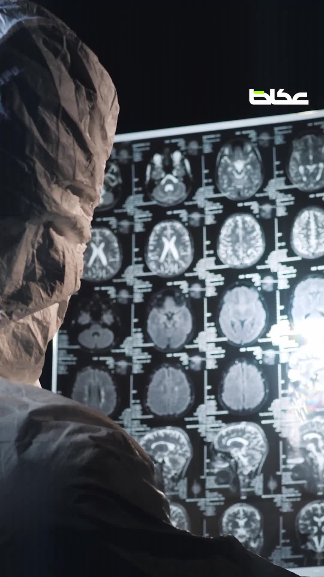 الصداع النصفي لم يعد عابرًا.. إنذار صحي لا يجب تجاهله