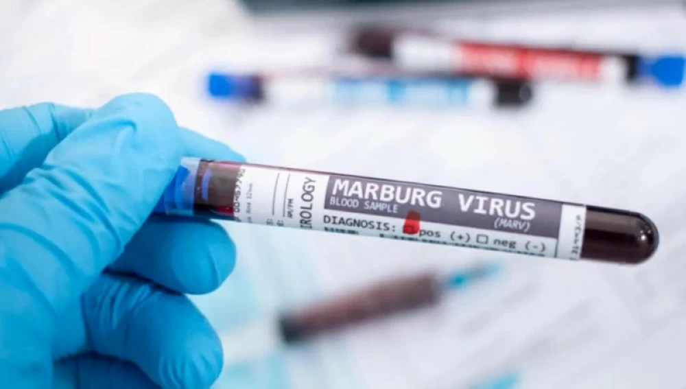 فايروس ماربورغ