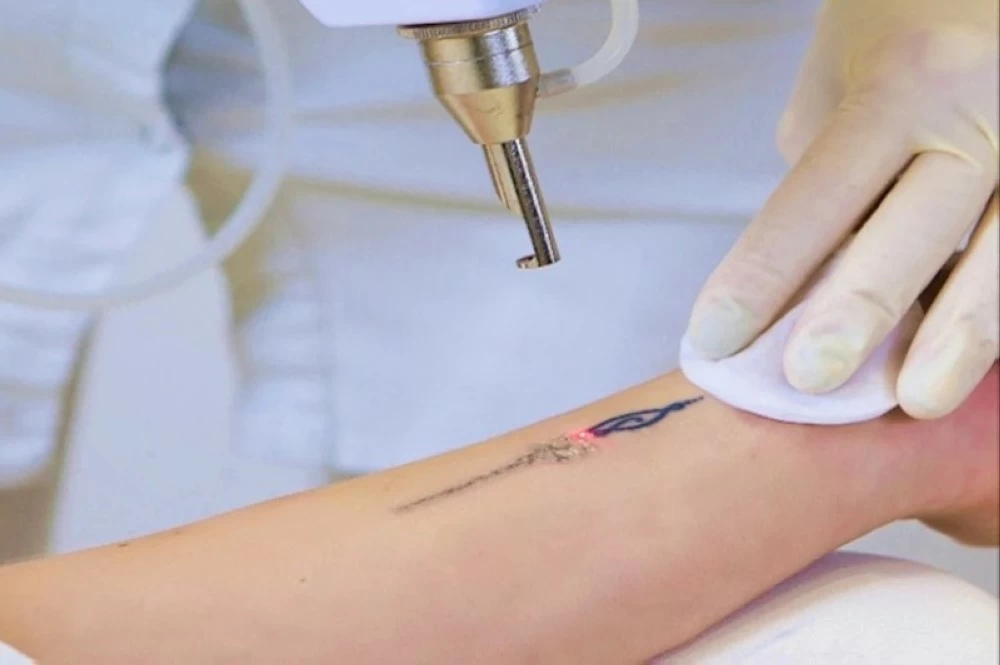 الوشم قد يزيد خطر سرطان الجلد بنسبة 29%.