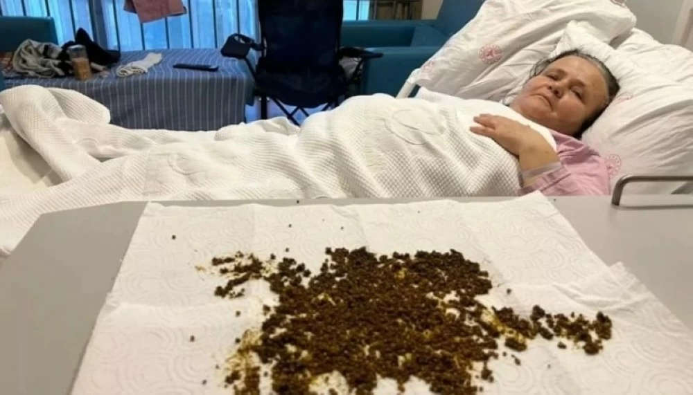 عانت المريضة من آلام شديدة بعد انتقال الحصوات إلى القناة الصفراوية الرئيسية متسببة بالتهاب حاد.