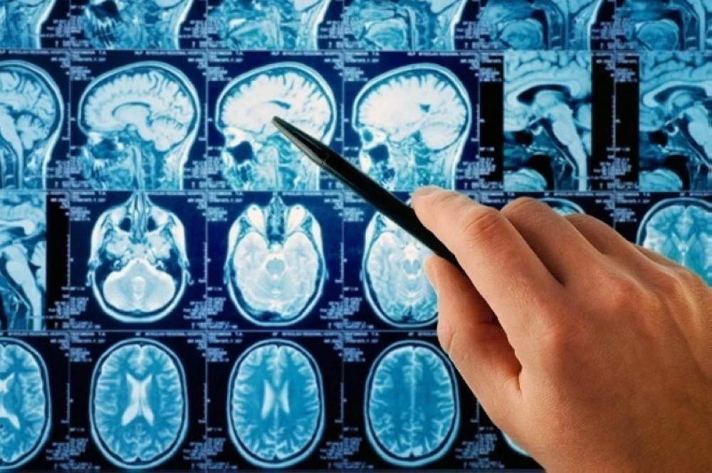 تحتوي قطرات الأنف على أحماض تحفز الجهاز المناعي لاستهداف السرطان.