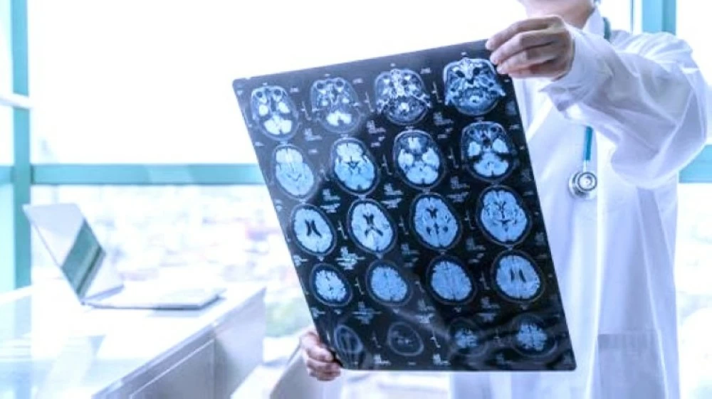 قطرات أنف نانوية تفتح أفقاً جديداً لعلاج السرطان – أخبار السعودية