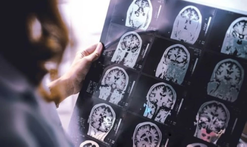 عاجل | علماء بريطانيون: علاجٌ ثوري للزهايمر خلال 5 إلى 10 سنوات. للاطلاع على 