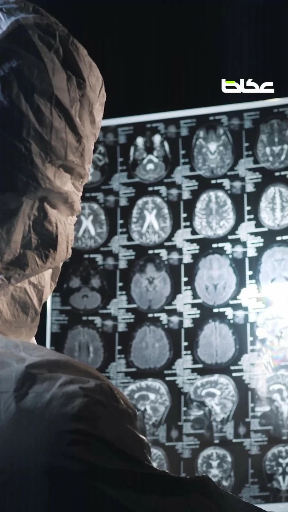 الصداع النصفي لم يعد عابرًا.. إنذار صحي لا يجب تجاهله