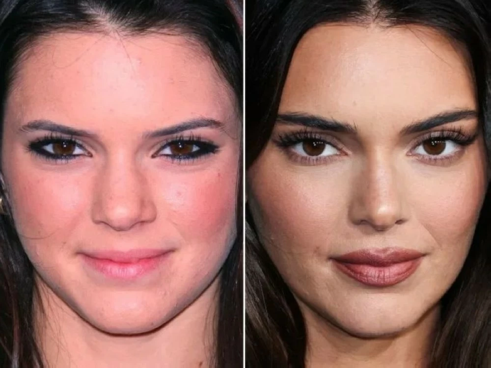 كيندال جينر