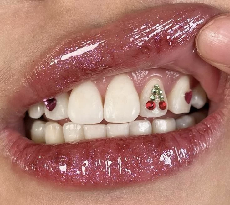 كرستالات الأسنان بين الترند الجمالي والجدل حول المبالغة والآثار الصحية