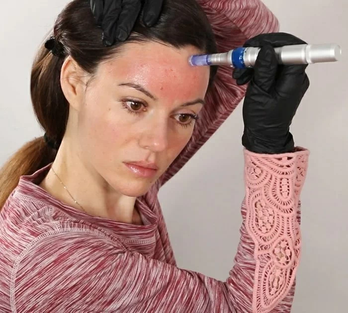 الديرما بن المنزلي.. بين الفائدة والمخاطر