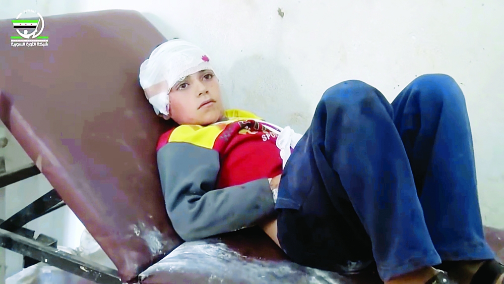 This frame grab from video provided by Muaz al-Shami, Syrian Revolution Network, an opposition activist media organization, that is consistent with independent AP reporting, shows a child on a hospital bed, with a bandage around his head after airstrikes killed over 20 people, in the northern rebel-held village of Hass, Syria, Wednesday, Oct 26, 2016. A team of first responders, the Syrian Civil Defense in Idlib, said at least 50 were wounded in the raids that used parachute mines, targeting the residential area and schools in the village of Hass.  Most of those killed were children, the group said on its Facebook page. (Muaz al-Shami, Syrian Revolution Network, via AP)