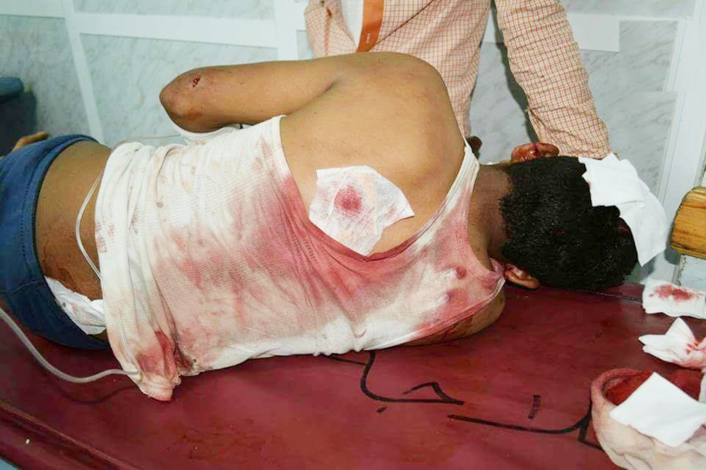 أحد ضحايا مجزرة بير باشا في تعز. (متداولة)