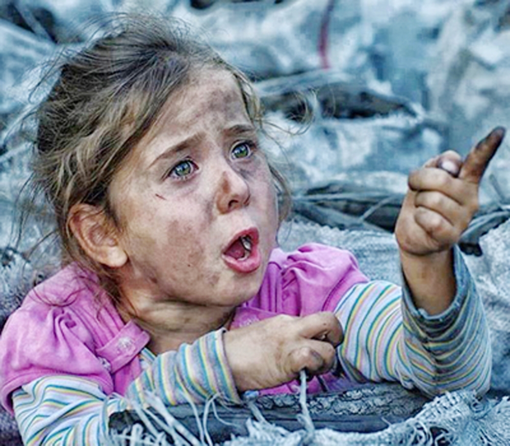 طفلة سورية مصابة نتيجة قصف قوات الأسد على إدلب. (متداولة)