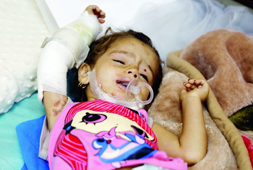 طفلة تتلقى العلاج بعد أن فقدت والدها وشقيقتيها في الموصل أمس الأول.
