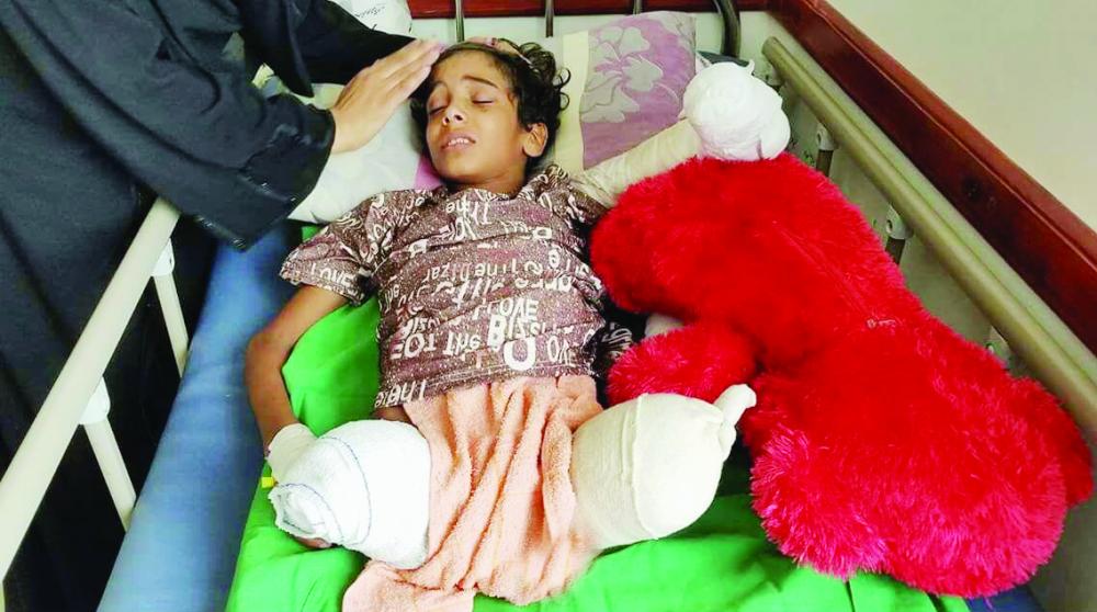 



طفل يمني بُترت رجلاه ويده.