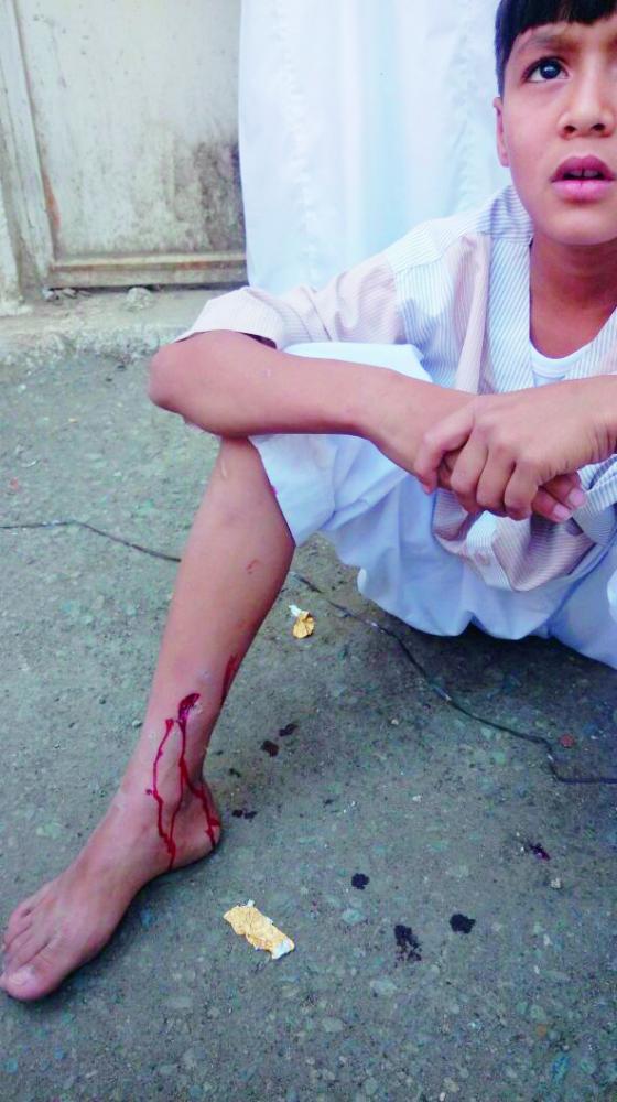



طفلان تعرضا إلى هجوم من كلاب ضالة في حي الملاوي.
