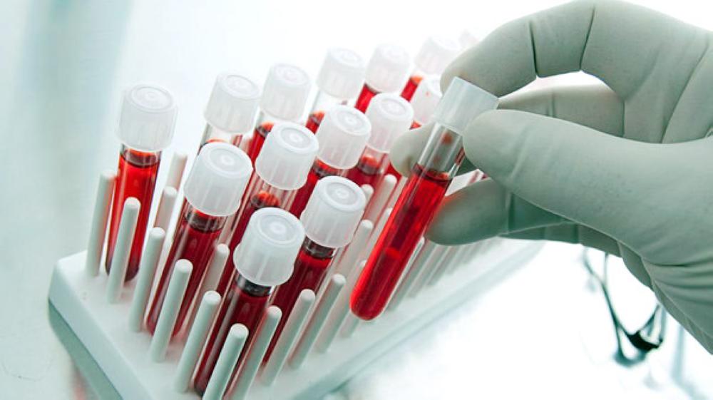 Blood samples in test-tubes