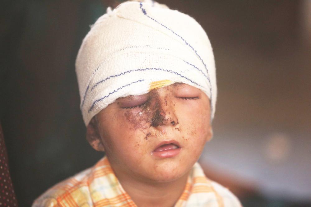 



طفل عراقي مصاب نازح من تلعفر يجلس في منزل في قرية العياضية أمس الأول. (أ. ف. ب)