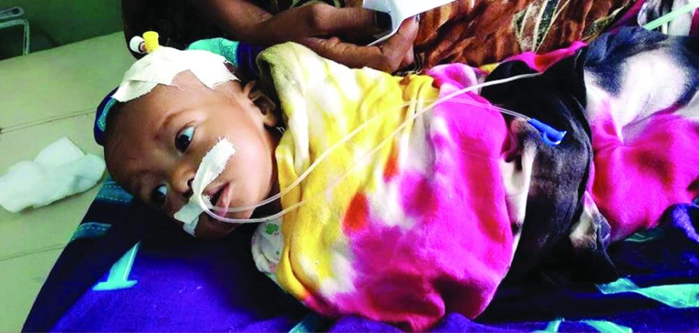 طفلة يمنية مصابة جراء قصف الميليشيات للأحياء السكنية في عدن.(الرصد الحقوقي)