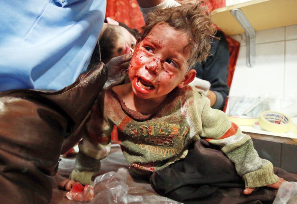 A Syrian child lies on an emergency room (ER) operating bed as he receives stitches from a paramedic due to injuries sustained from shellings, in the rebel-controlled town of Kafr Batna, in the eastern Ghouta region on the outskirts of the capital Damascus, on October 20, 2017.  / AFP / ABDULMONAM EASSA
