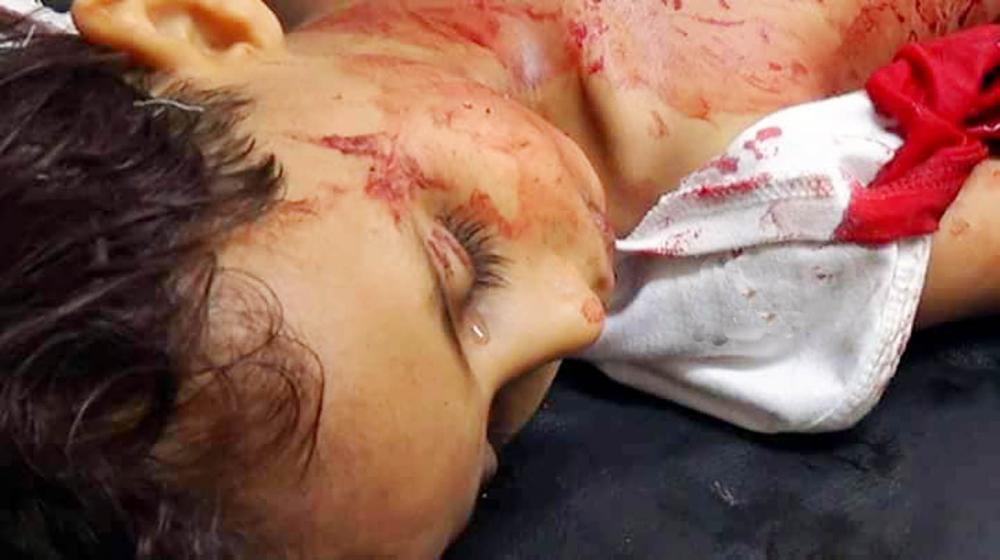 



طفلة يمنية اغتالتها ميليشيا الانقلاب في تعز. (أرشيفية)