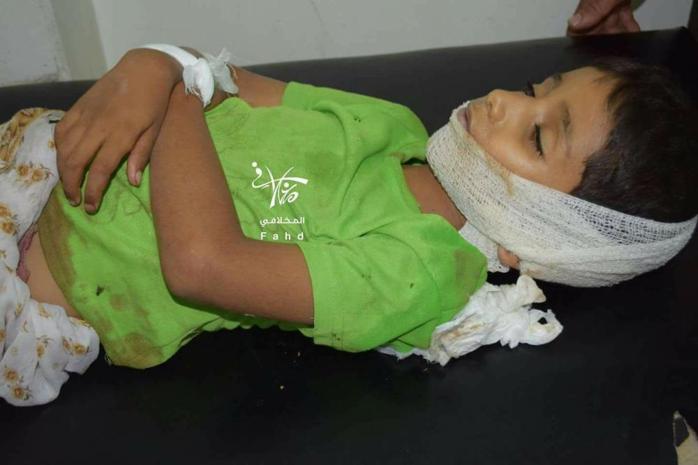 



طفل يمني قتلته الميليشيات الانقلابية في تعز. (متداولة)