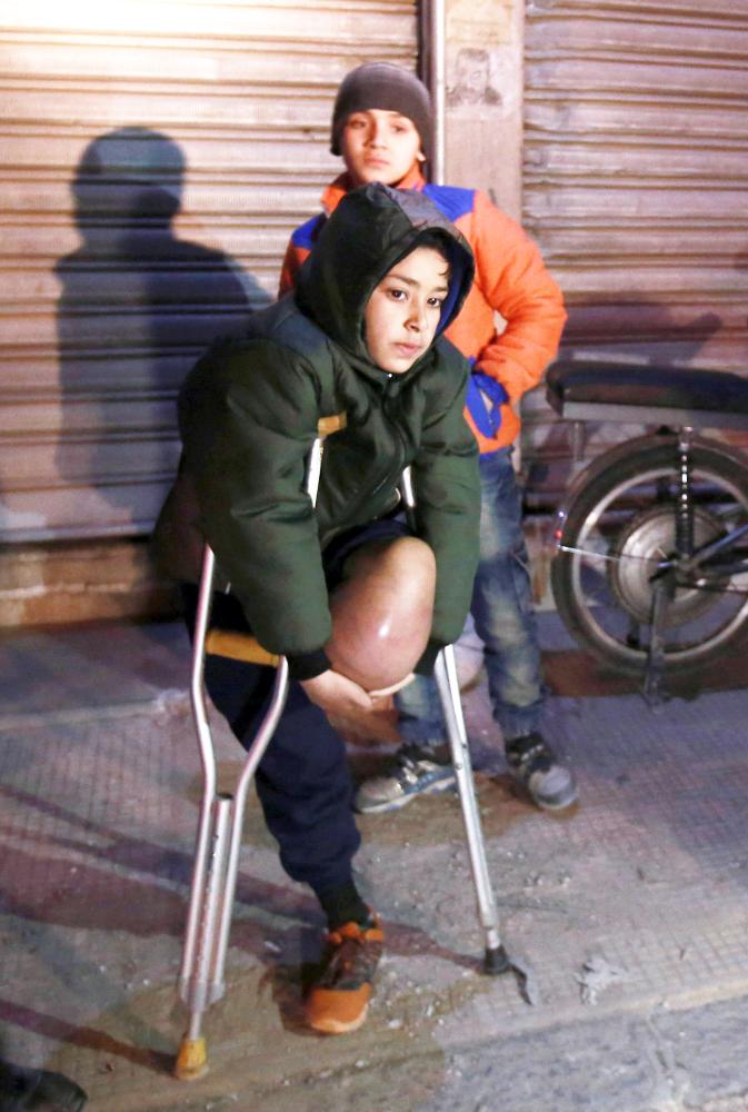 



طفل سوري بترت ساقه ينتظر دوره للإجلاء من الغوطة أمس الأول. (أ. ف. ب) 