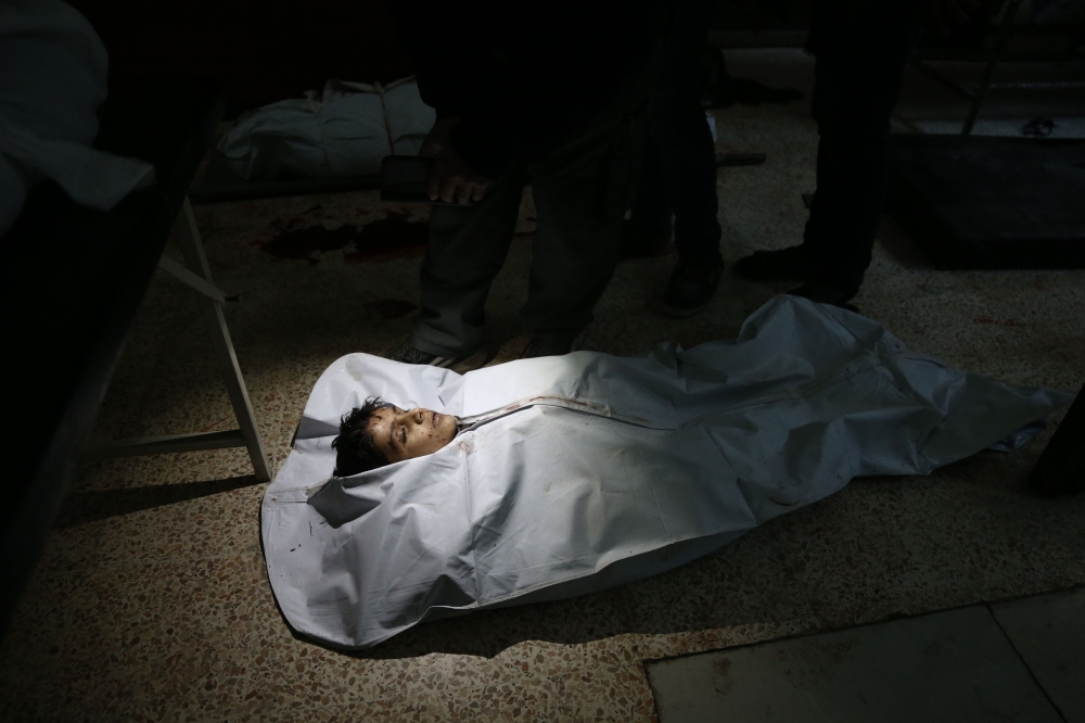 EDITORS NOTE: Graphic content / TOPSHOT - The body of a young victim lies on the ground at a makeshift hospital following reported artillery shelling in Hammuriyeh in the rebel-held Eastern Ghouta area, on the outskirts of the capital Damascus, on January 12, 2018.  / AFP / ABDULMONAM EASSA
