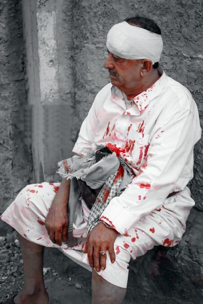 يمني أصيب في قصف مليشيا الحوثي على تعز. (تصوير: أحمد الباشا)