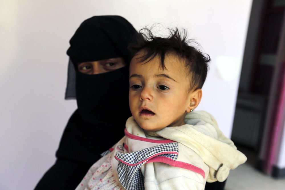 epa06713603 A Yemeni woman holds her malnourished child at a hospital amid worsening malnutrition, in Sana'a, Yemen, 05 May 2018. According to reports, an estimated 3.3 million children in Yemen are malnourished, with more than 400 thousand children under the age of five facing severely malnutrition.  EPA/YAHYA ARHAB