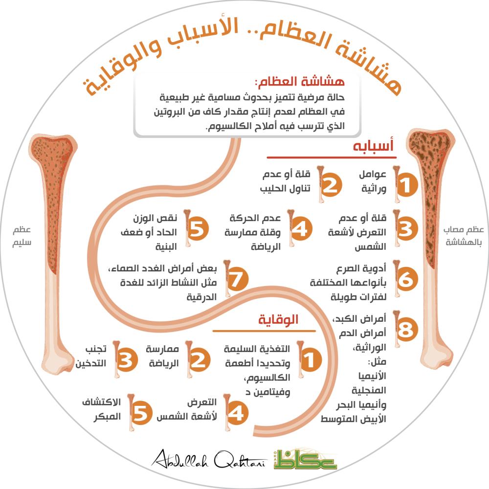 يسعد صباحكم هشاشة العظام يهم كل د لؤي سيد أحمد اخصائي الاطفال Loai Kids Clinic Facebook