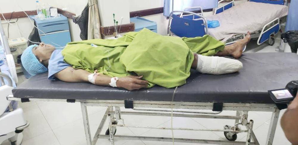 



 اليمنية فاطمة (45 عاماً) ترقد في مستشفى بتعز بعد أن فقدت قدمها في انفجار لغم حوثي. (تصوير: عامر العامري)