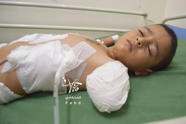 أطفال من تعز اغتالهم الحوثي. 