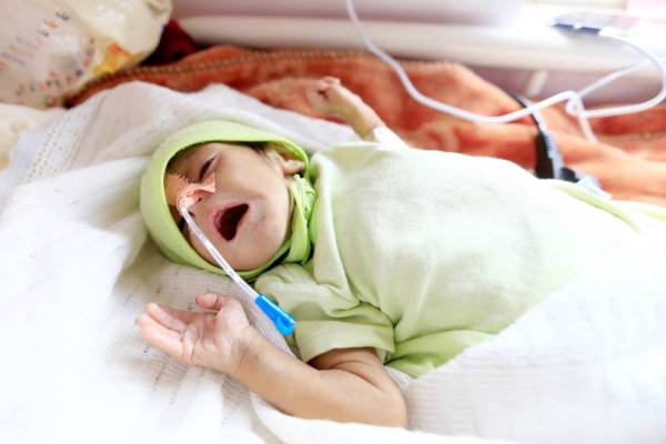 



طفل يمني يعاني من سوء التغذية يتلقى العلاج في مستشفى السبعين للأمومة في صنعاء أمس الأول. (أ ف ب)