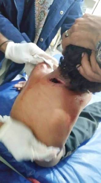 



طفل يمني قتله رصاص المليشيا الذي اخترق جسده في قصف عشوائي على قرى الضالع أمس. (إعلام الجيش اليمني)
