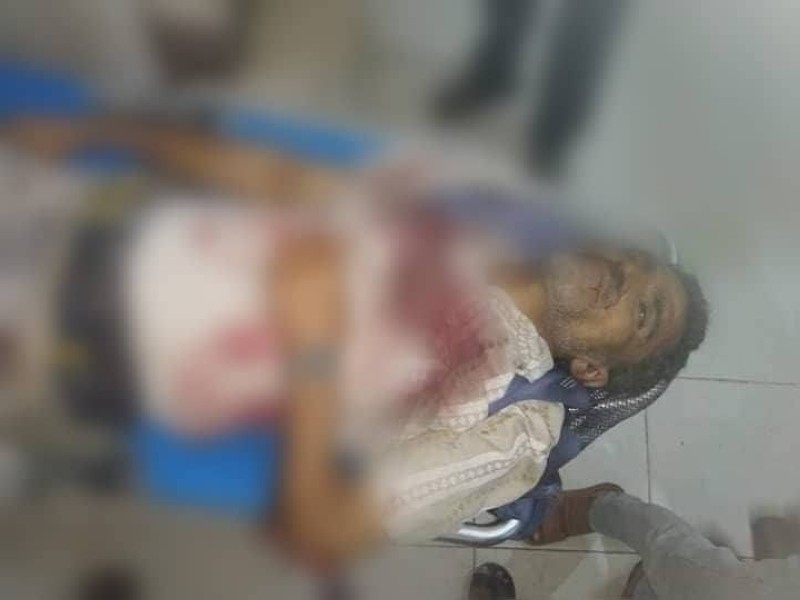 إحدى ضحايا مجزرة المجند الحوثي.