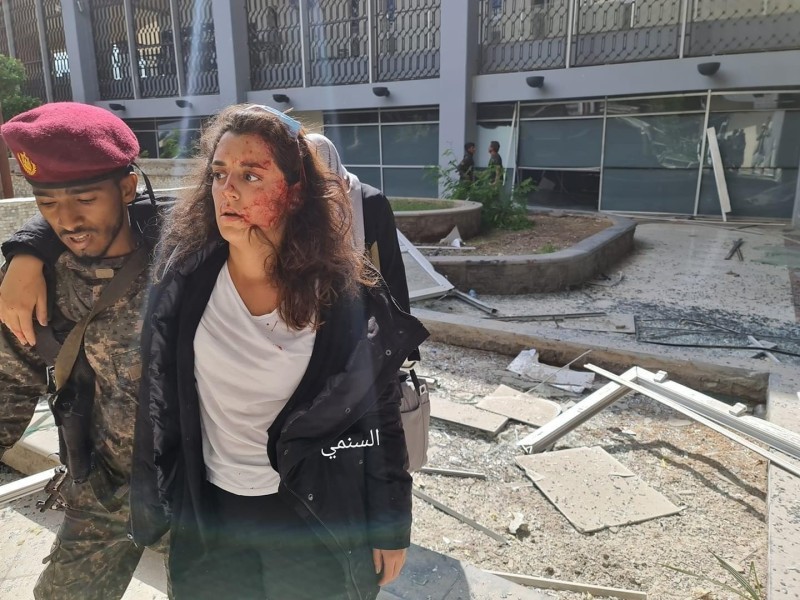 



متحدثة الصليب الأحمر الدولي  يارا خواجة تتلقى المساعدة من جندي يمني عقب إصابتها في الهجوم الإرهابي على مطار عدن أمس.
