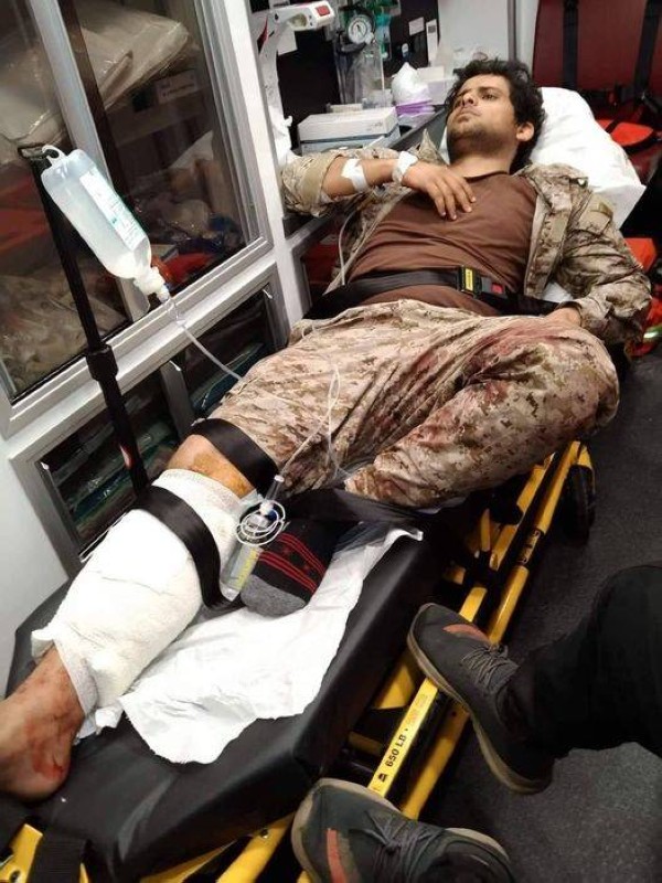 مصاب في قصف حوثي لحفل إيقاد شعلة 26 سبتمبر.
