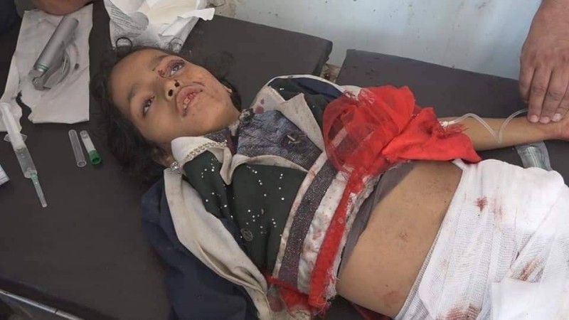 طفة قتلتها المليشيا في قصف لمناطق سكنية في تعز.