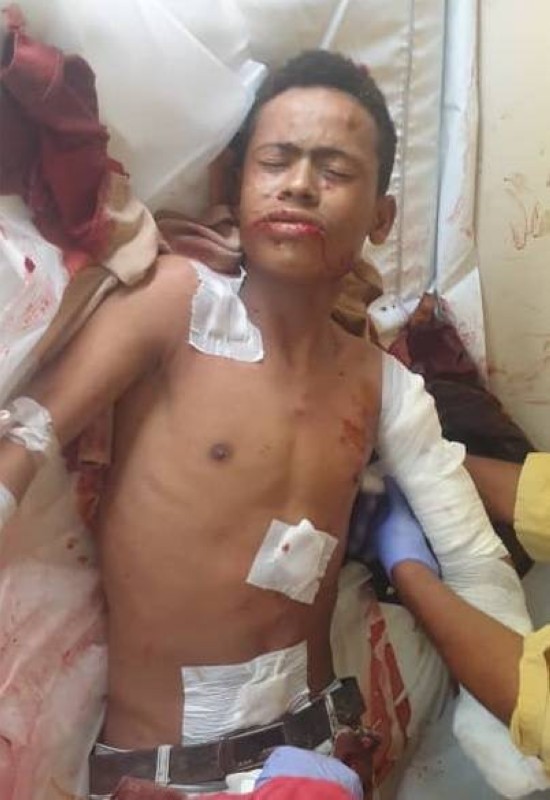إحدى ضحايا القصف الحوثي في تعز. 