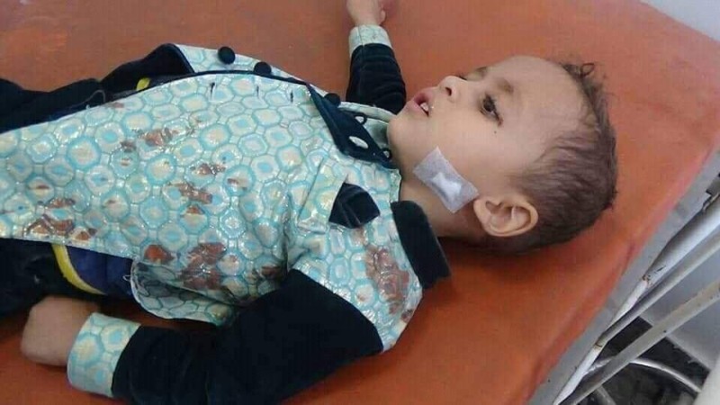 أحد الأطفال ضحايا القصف الحوثي على تعز اليوم.
