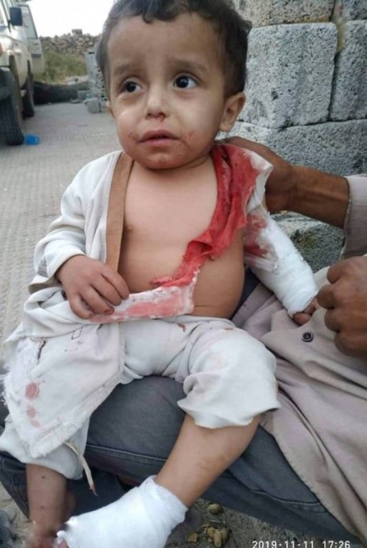 طفل من ضحايا القصف الحوثي على تعز.