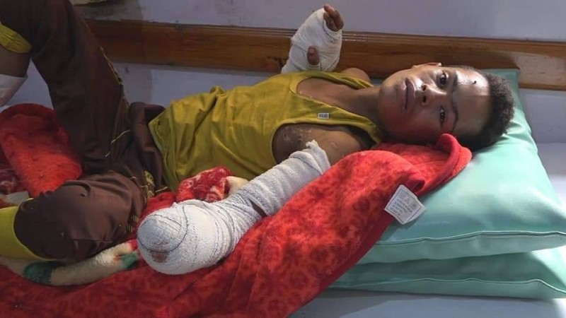 طفل يمني اصيب مع أسرته في قصف حوثي على منزلهما في مقبنة غرب تعز