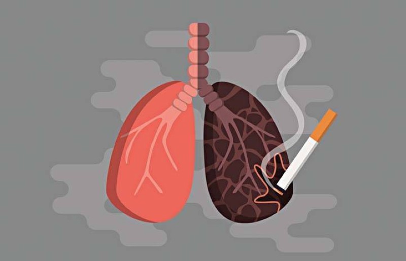المدخنون أكثر عرضة لسرطان الرئة