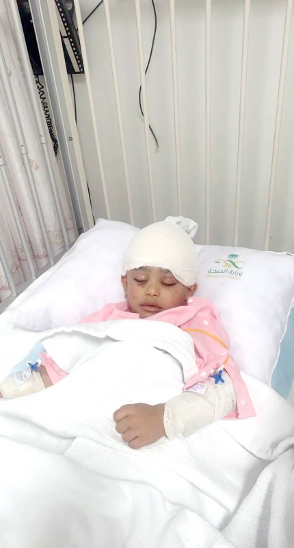 الطفل سيف اليامي بعد إجراء العملية الجراحية.