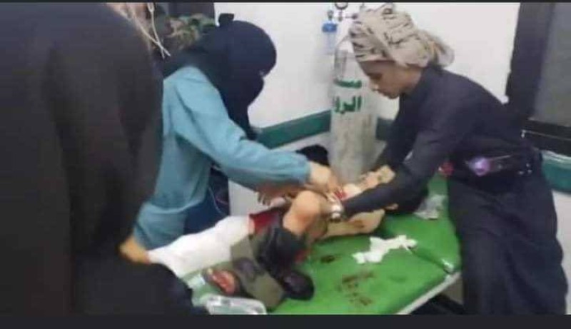 أطباء يحاولون انقاذ طفلة اصيبت بالقصف الحوثي