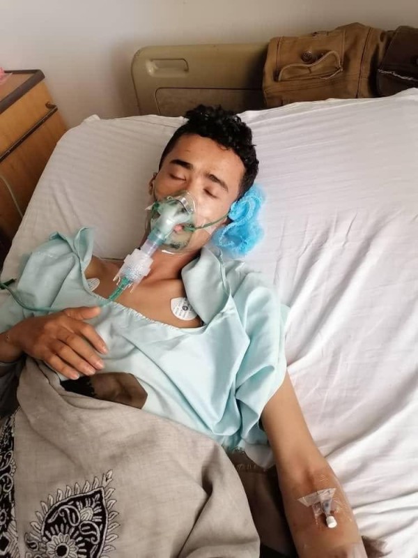 مختطف يمني توفي عقب خروجه من سجن الحوثي جراء التعذيب الذي تعرض له