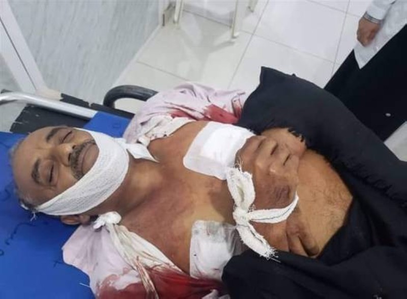 يمني قتلته المليشيا الحوثية قنصاً في تعز أمس.