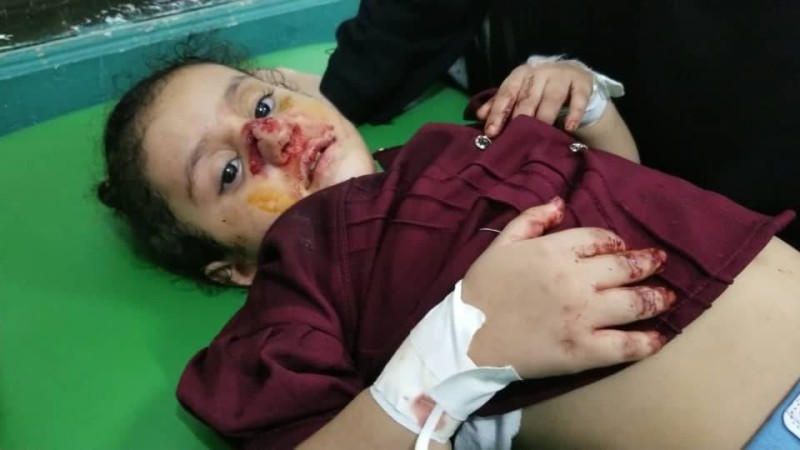 طفلة أصيبت في قصف حوثي على تعز  