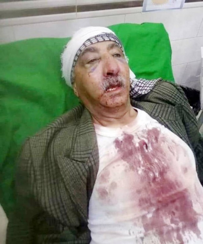 زعيم قبلي غارق في دمه عقب اعتداء حوثي عليه في عمران.