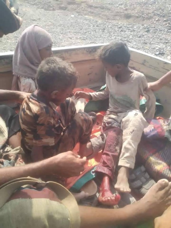 أطفال يمنيون أصيبوا بجروح .بقصف حوثي بطائرة مسيرة 