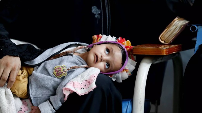 طفل يمني من ضحايا الحوثي.