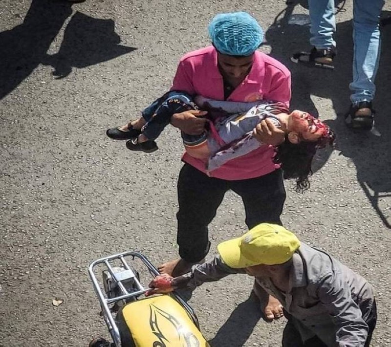 يمني يحمل طفلة قتلت في انفجار عبوة ناسفة بدورية عسكرية في تعز اليوم
